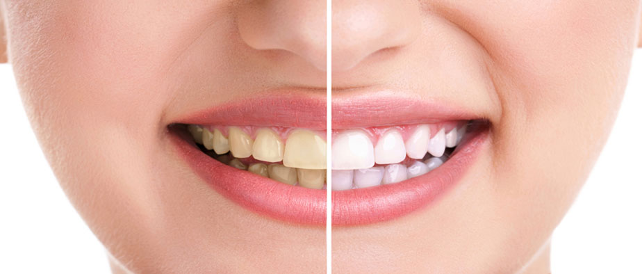 Muskan Dental Care & Oral Health Care Centre